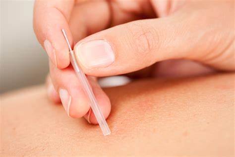 Chest Physiotherapy